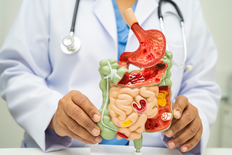 σπαστική κολίτιδα