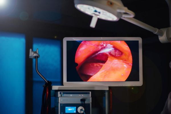 κολονοσκόπηση