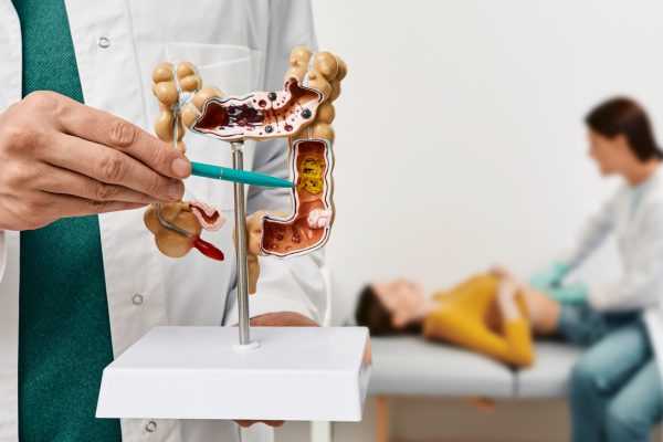 καρκίνος παχέος εντέρου