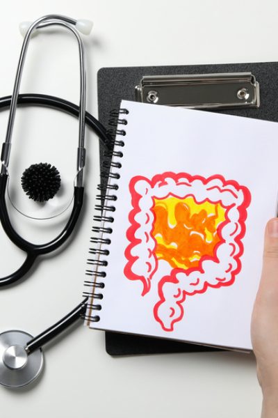 ευερέθιστο έντερο